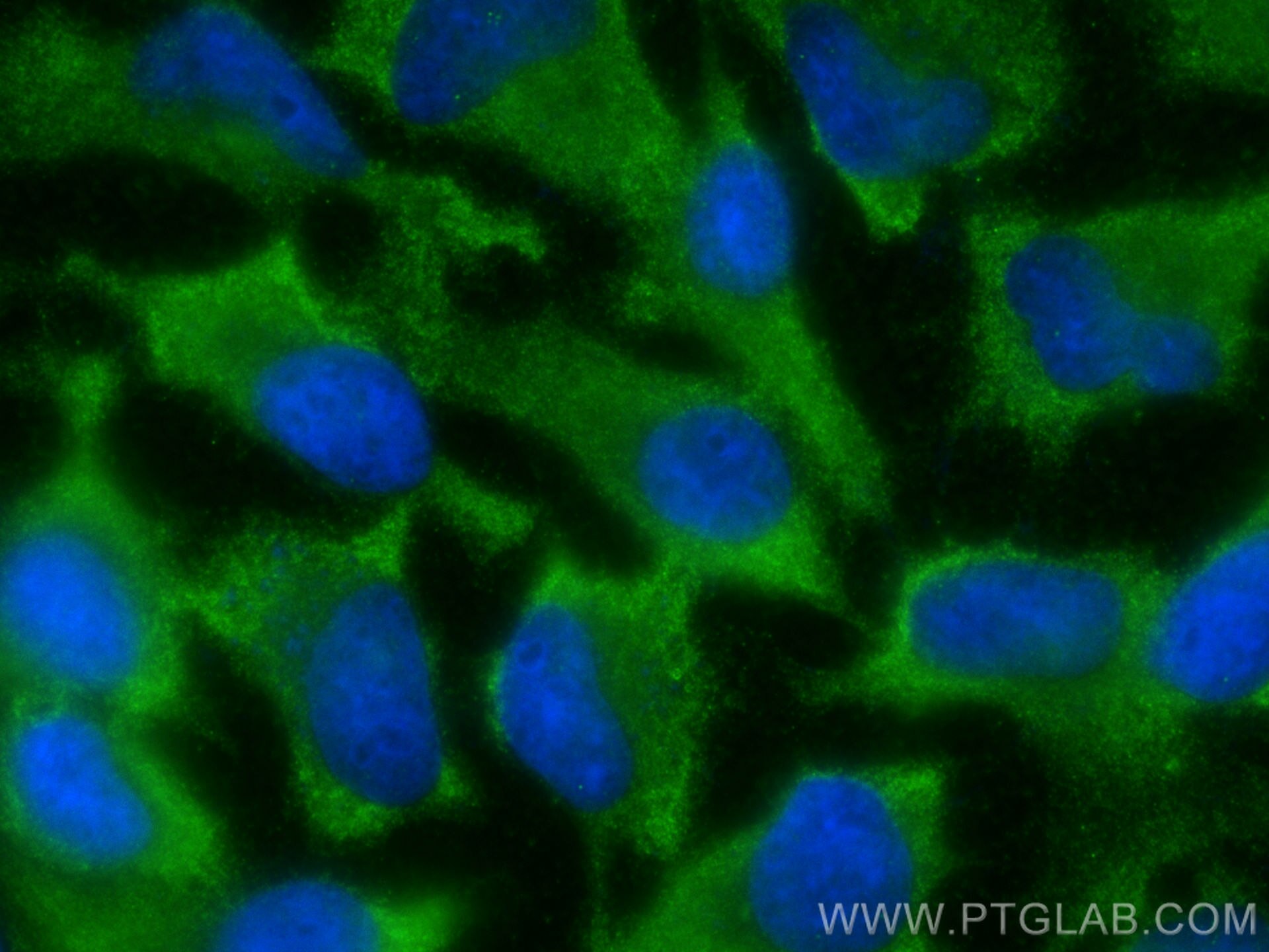 Immunofluorescence (IF) / fluorescent staining of HeLa cells using TGFB2/TGF-beta 2 Polyclonal antibody (28426-1-AP)