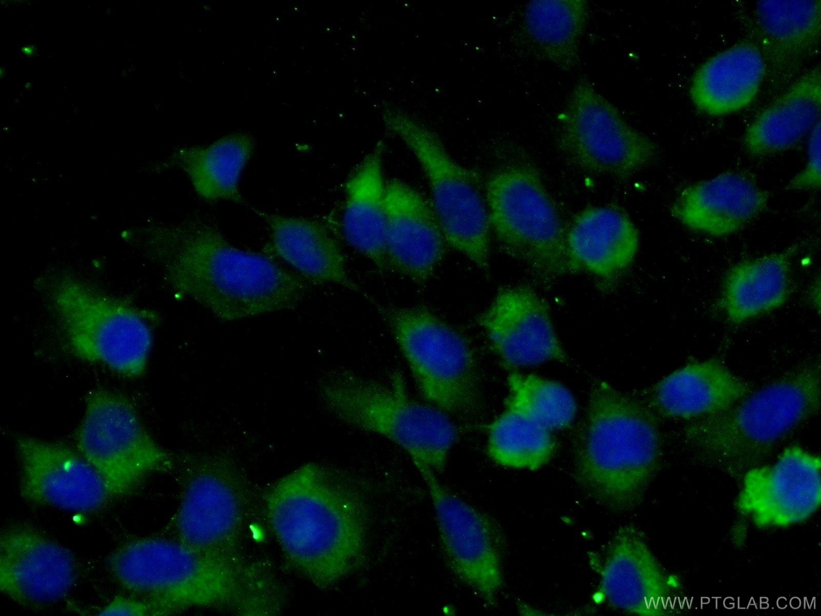 Immunofluorescence (IF) / fluorescent staining of A431 cells using TGF alpha Polyclonal antibody (22308-1-AP)