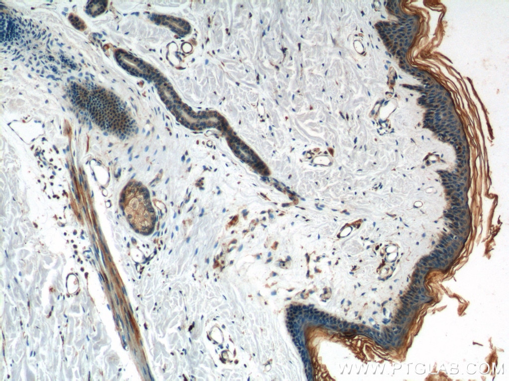 Immunohistochemistry (IHC) staining of human skin tissue using TGF Alpha Polyclonal antibody (22308-1-AP)