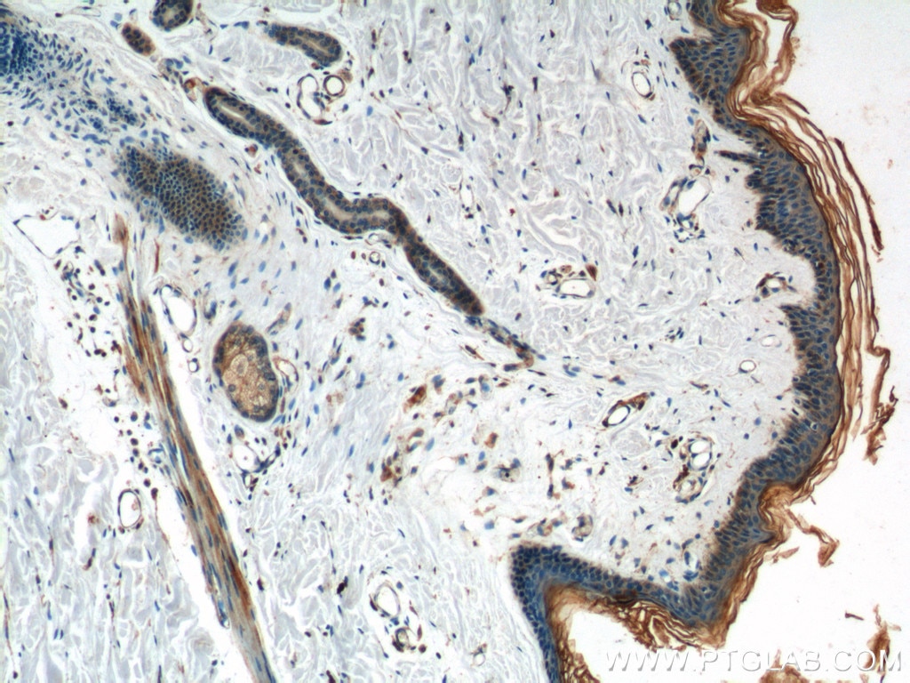 IHC staining of human skin using 22308-1-AP