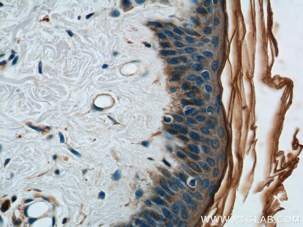 Immunohistochemistry (IHC) staining of human skin tissue using TGF Alpha Polyclonal antibody (22308-1-AP)