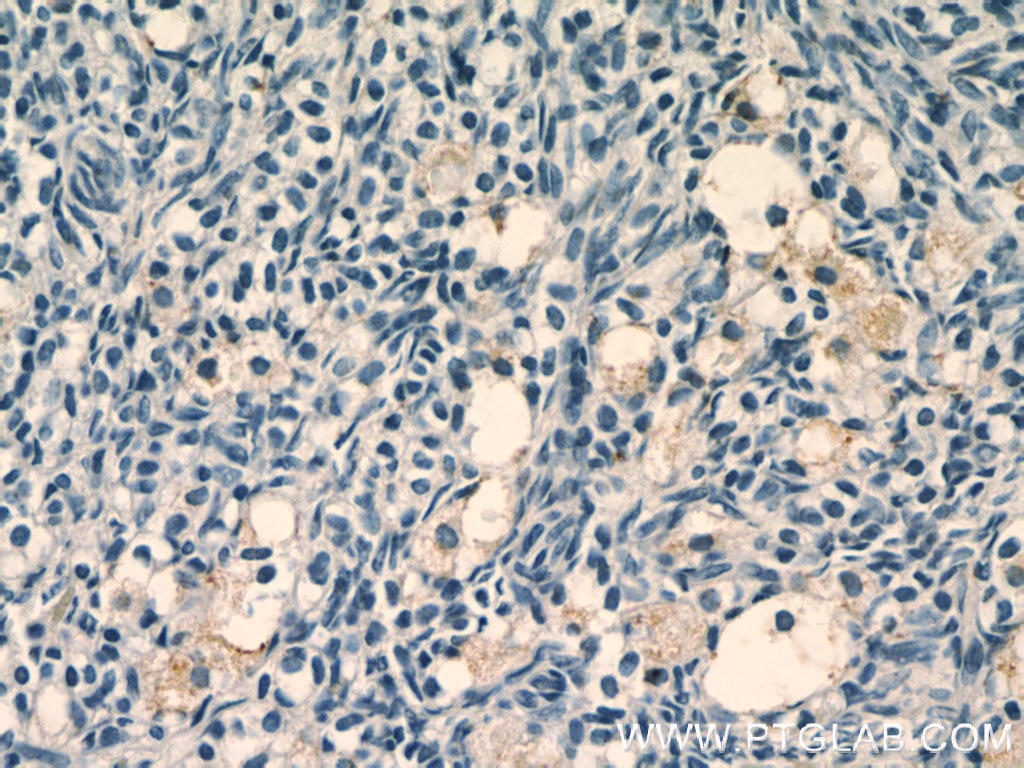 TGF Beta 1 Polyclonal antibody