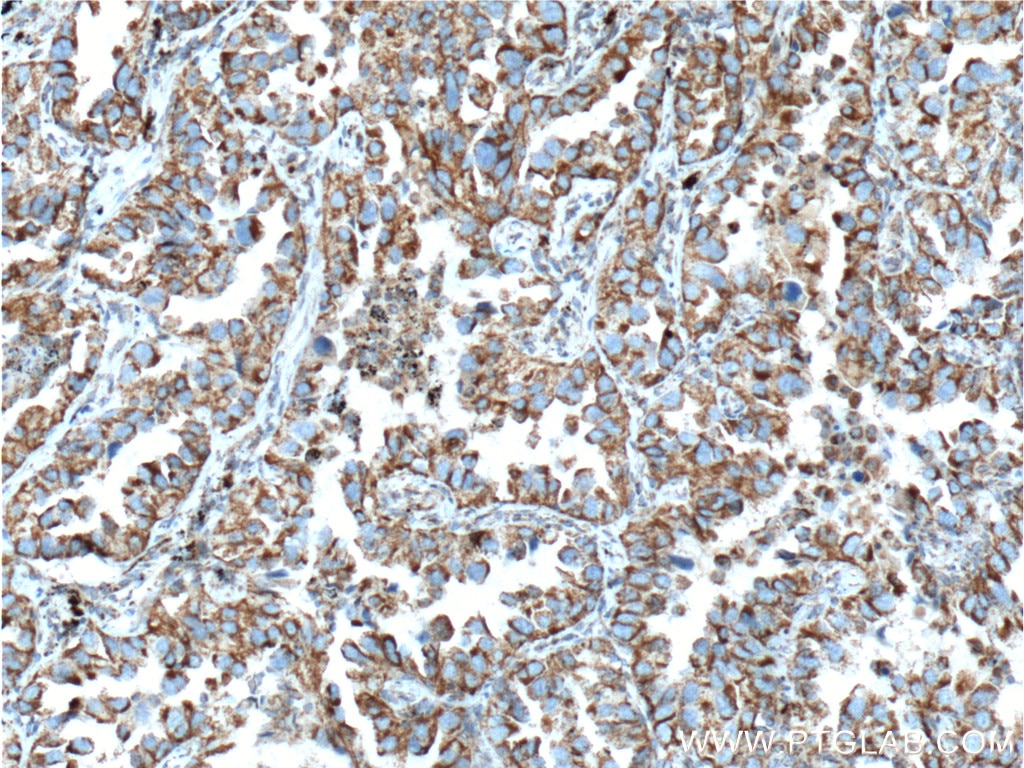 TGF Beta 1 Polyclonal antibody