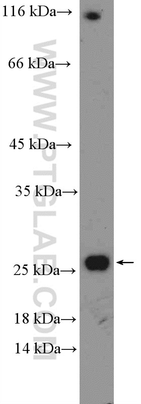 TGF Beta 1 Polyclonal antibody