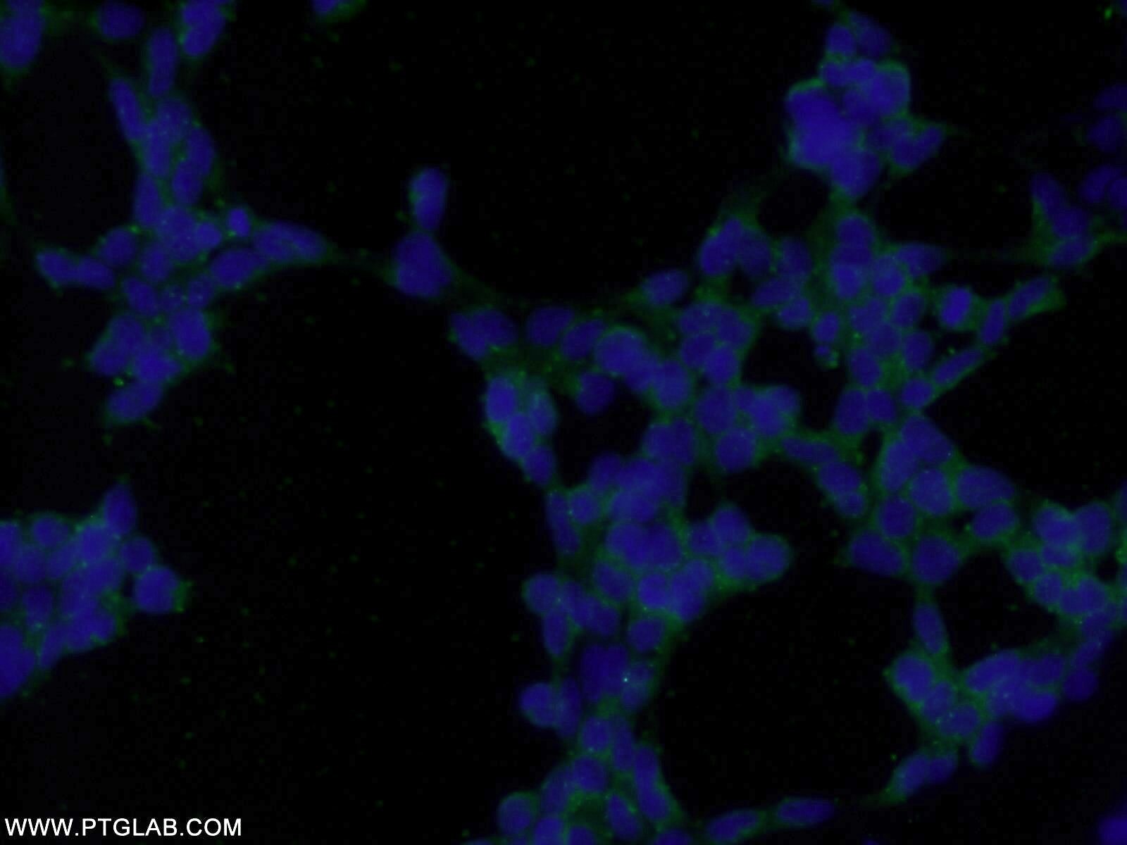 HIC5 Polyclonal antibody