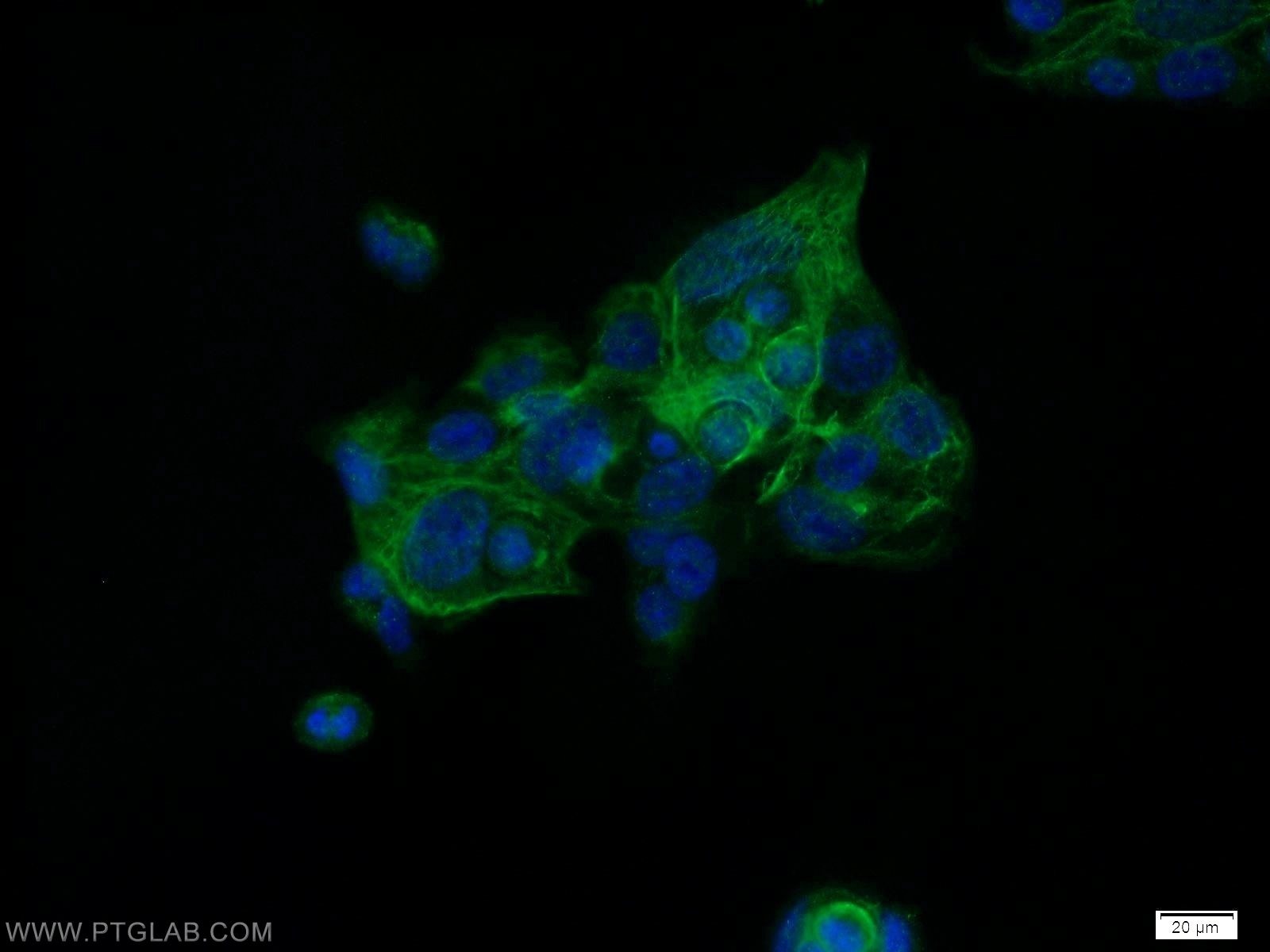 Immunofluorescence (IF) / fluorescent staining of A431 cells using HIC5 Polyclonal antibody (10565-1-AP)