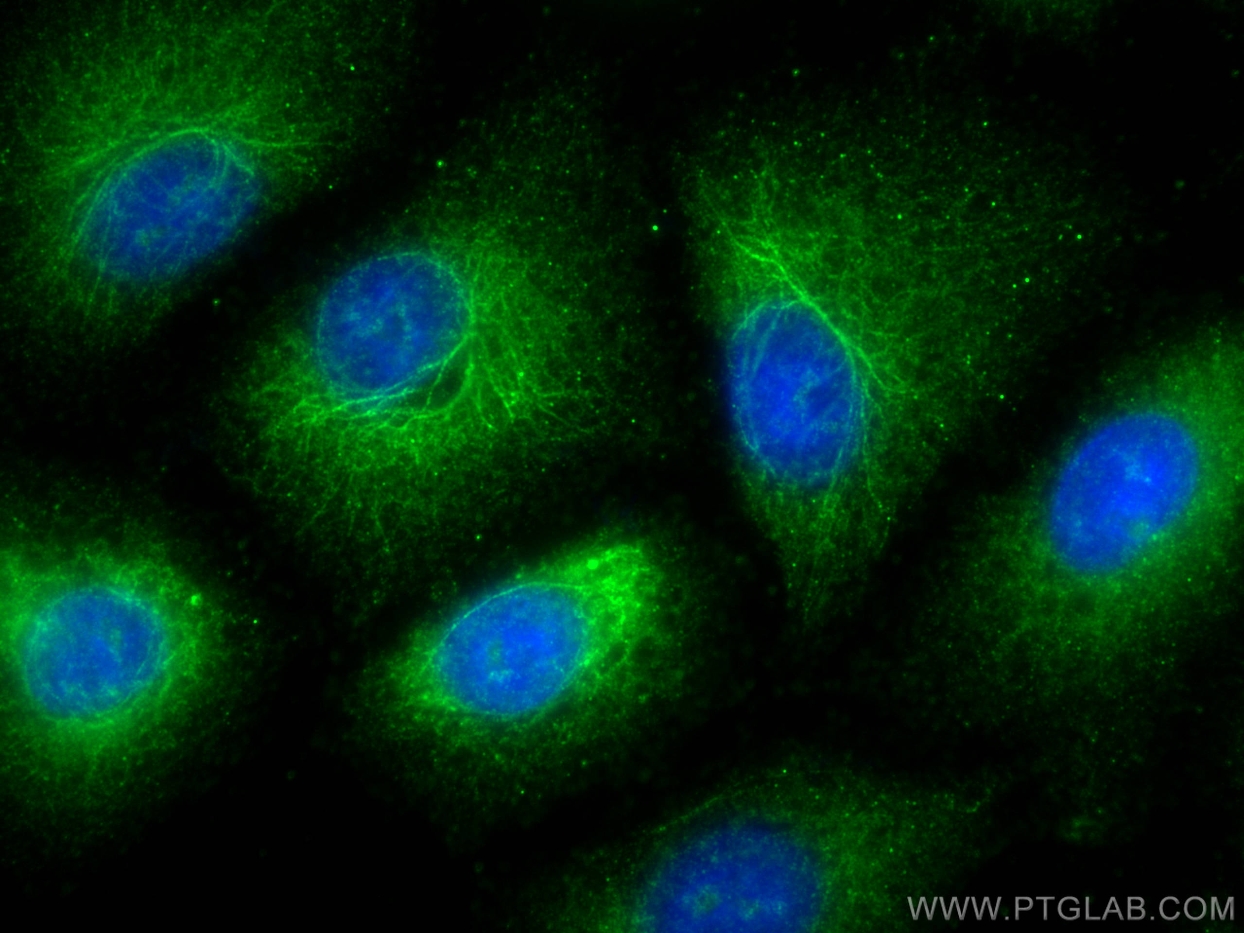 Immunofluorescence (IF) / fluorescent staining of A549 cells using HIC5 Polyclonal antibody (10565-1-AP)