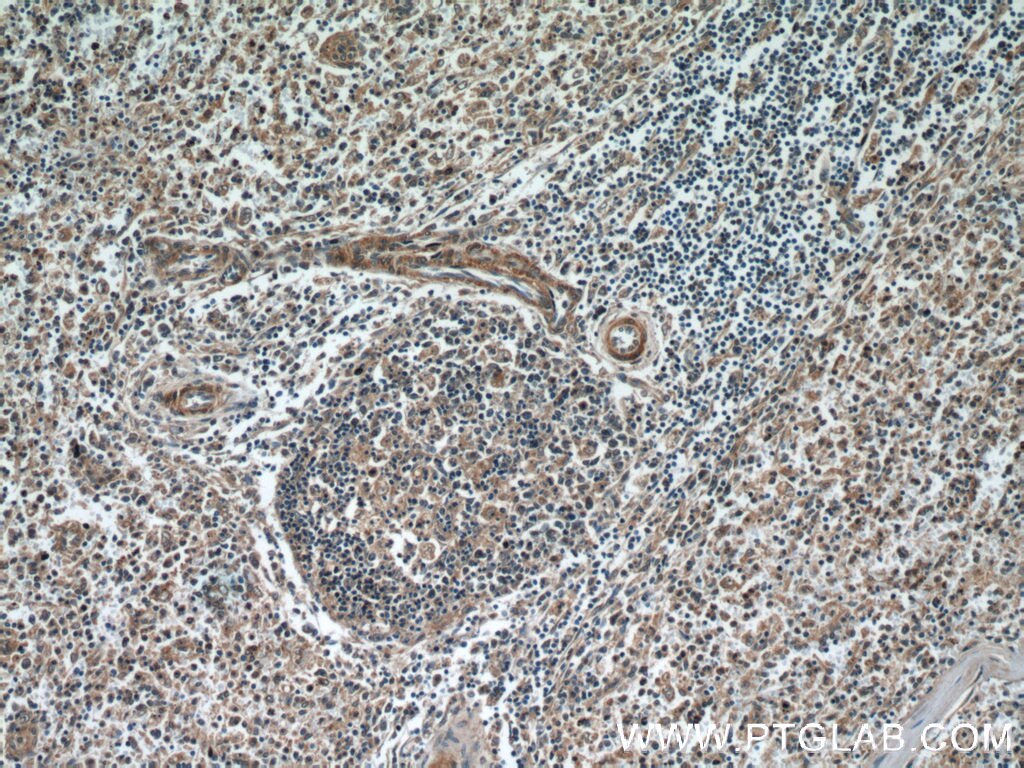 Immunohistochemistry (IHC) staining of human spleen tissue using HIC5 Polyclonal antibody (10565-1-AP)