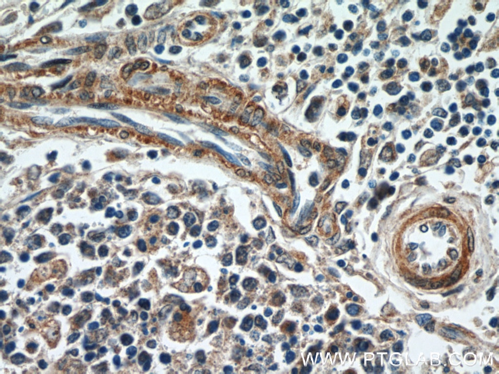 Immunohistochemistry (IHC) staining of human spleen tissue using HIC5 Polyclonal antibody (10565-1-AP)