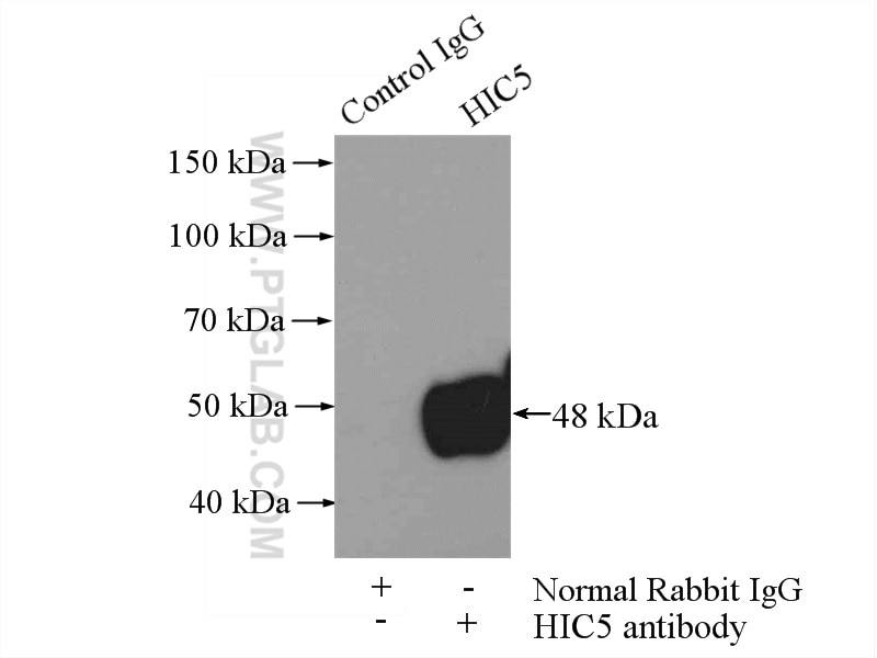 Immunoprecipitation (IP) experiment of A431 cells using HIC5 Polyclonal antibody (10565-1-AP)
