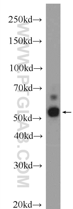 Western Blot (WB) analysis of A431 cells using HIC5 Polyclonal antibody (10565-1-AP)