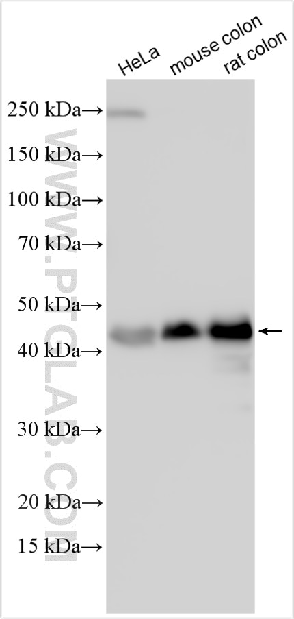 Western Blot (WB) analysis of various lysates using HIC5 Polyclonal antibody (10565-1-AP)