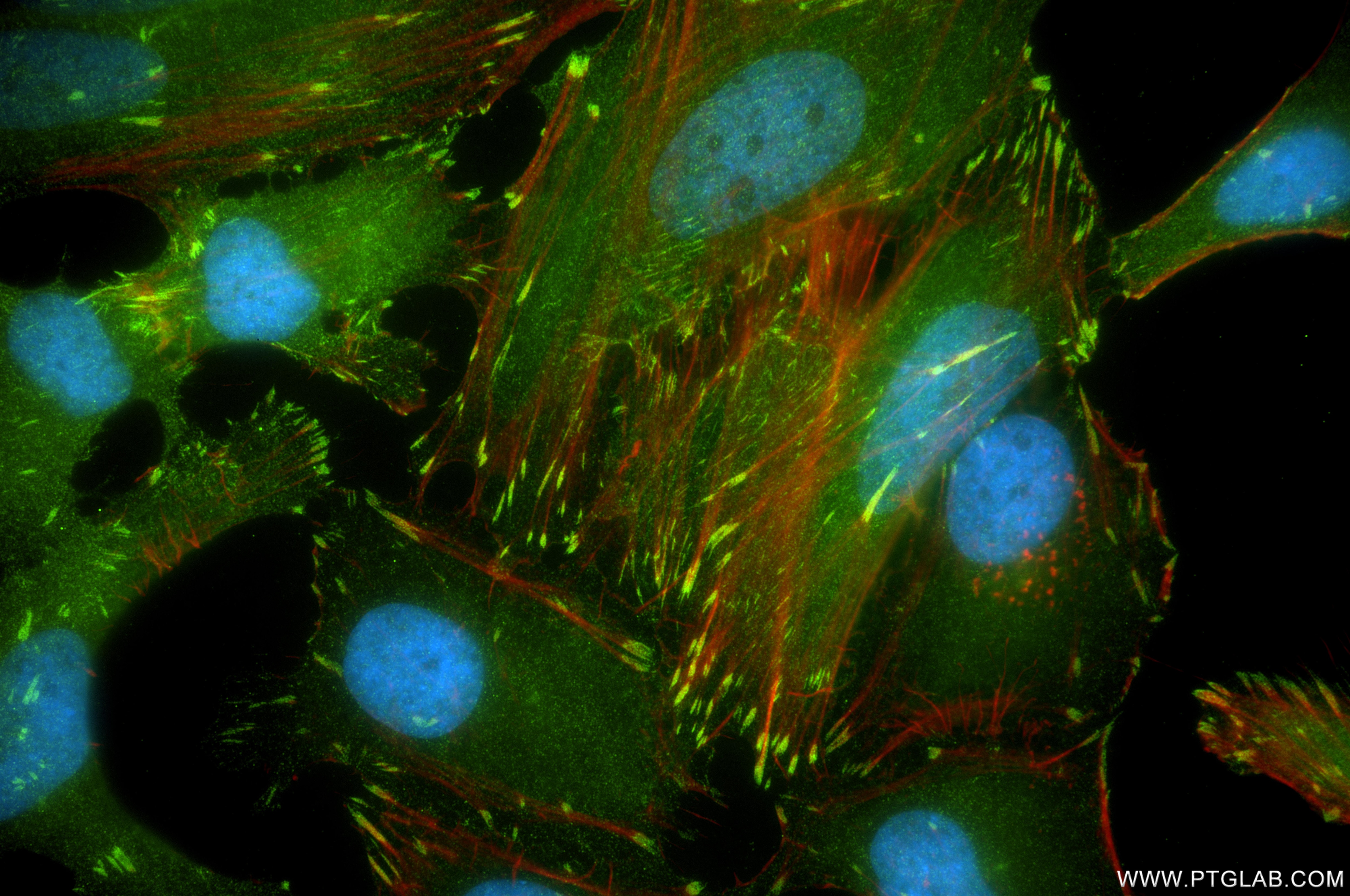 Immunofluorescence (IF) / fluorescent staining of HeLa cells using HIC5 Recombinant monoclonal antibody (85859-5-RR)