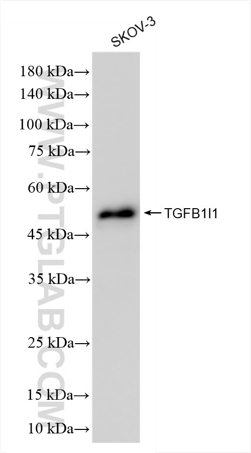 TGFB1I1