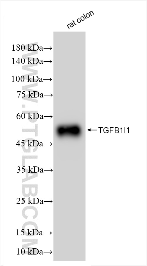 Western Blot (WB) analysis of rat colon tissue using TGFB1I1 Recombinant antibody (85859-5-RR)