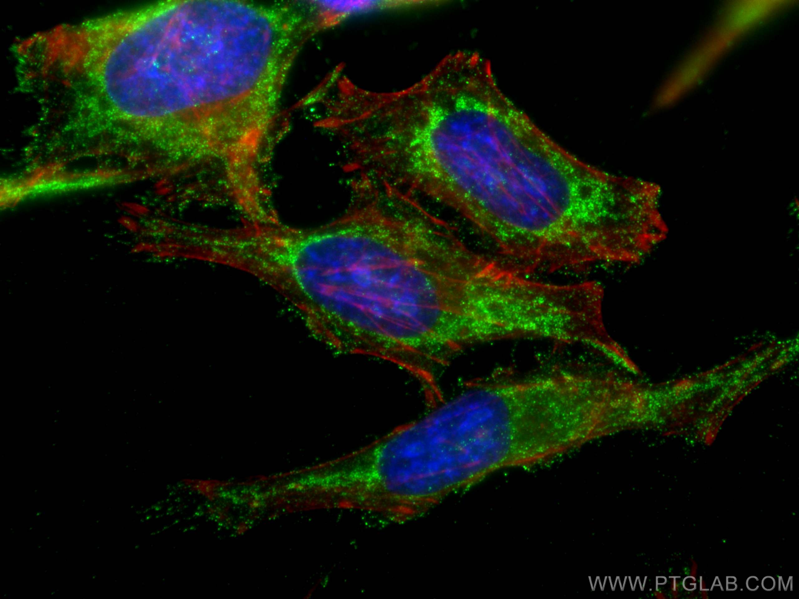 Immunofluorescence (IF) / fluorescent staining of HeLa cells using TGF beta 2-Specific Polyclonal antibody (19999-1-AP)