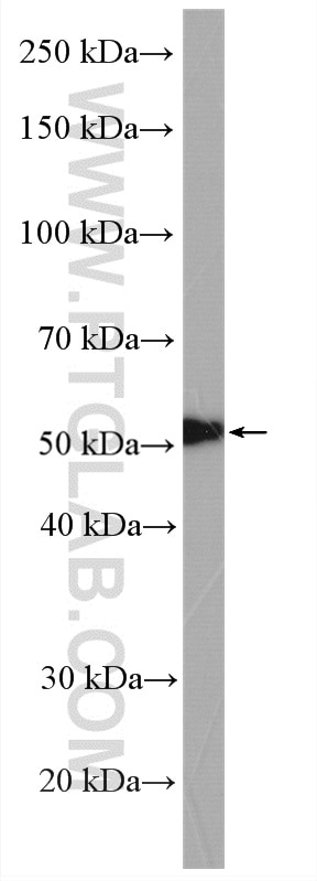Western Blot (WB) analysis of HeLa cells using TGF beta 2-Specific Polyclonal antibody (19999-1-AP)