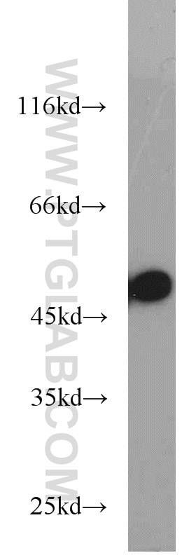 TGF beta 2-Specific Polyclonal antibody