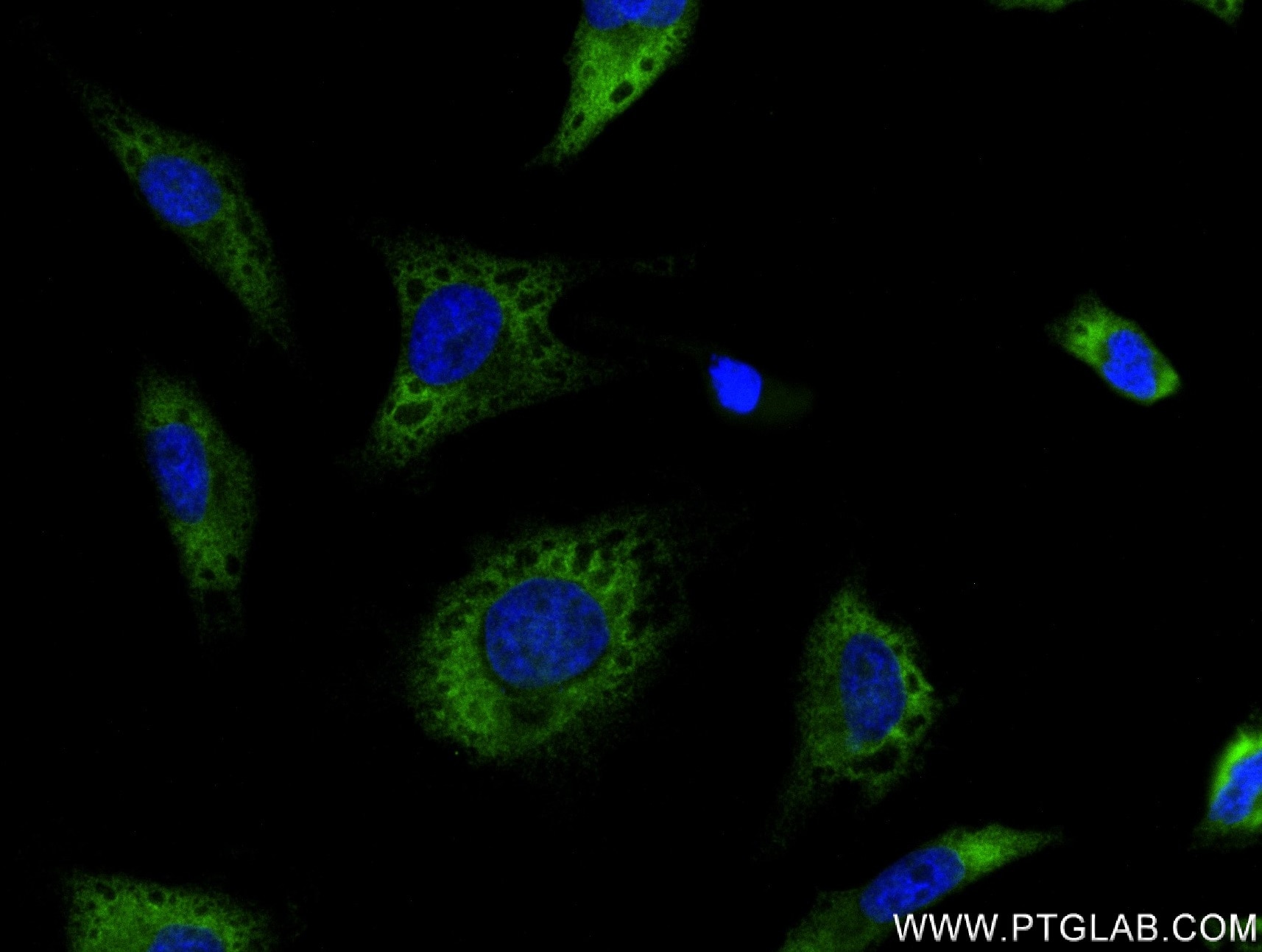 Immunofluorescence (IF) / fluorescent staining of HeLa cells using TGFB2/TGF-beta 2 Recombinant antibody (83167-5-RR)
