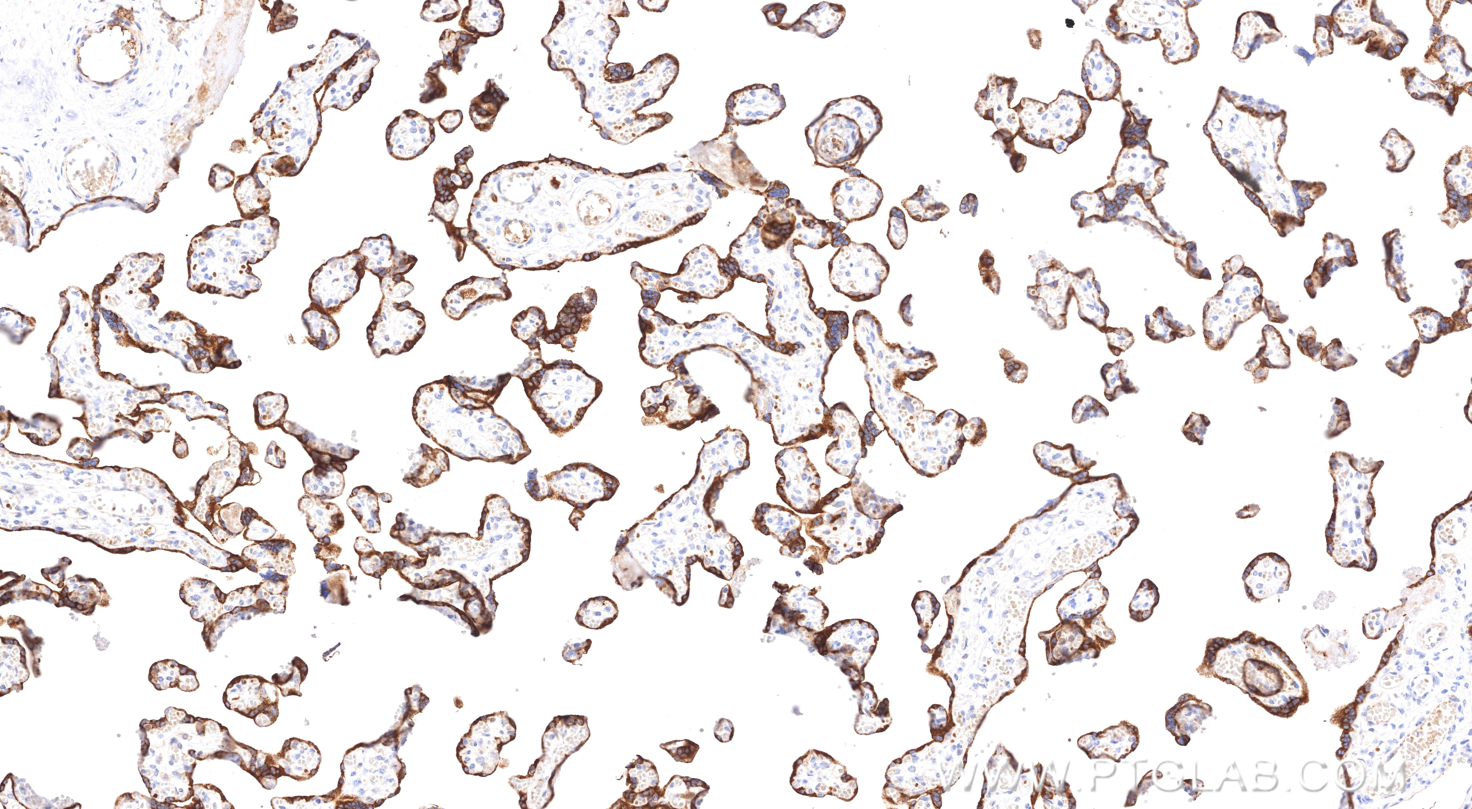 Immunohistochemical analysis of paraffin-embedded human placenta tissue slide using 83167-5-RR (TGFB2/TGF-beta 2 antibody) at dilution of 1:300 (under 10x lens). Heat mediated antigen retrieval with Tris-EDTA buffer (pH 9.0). Immunohistochemistry (IHC) staining of human placenta tissue using TGFB2/TGF-beta 2 Recombinant monoclonal antibody (83167-5-RR)