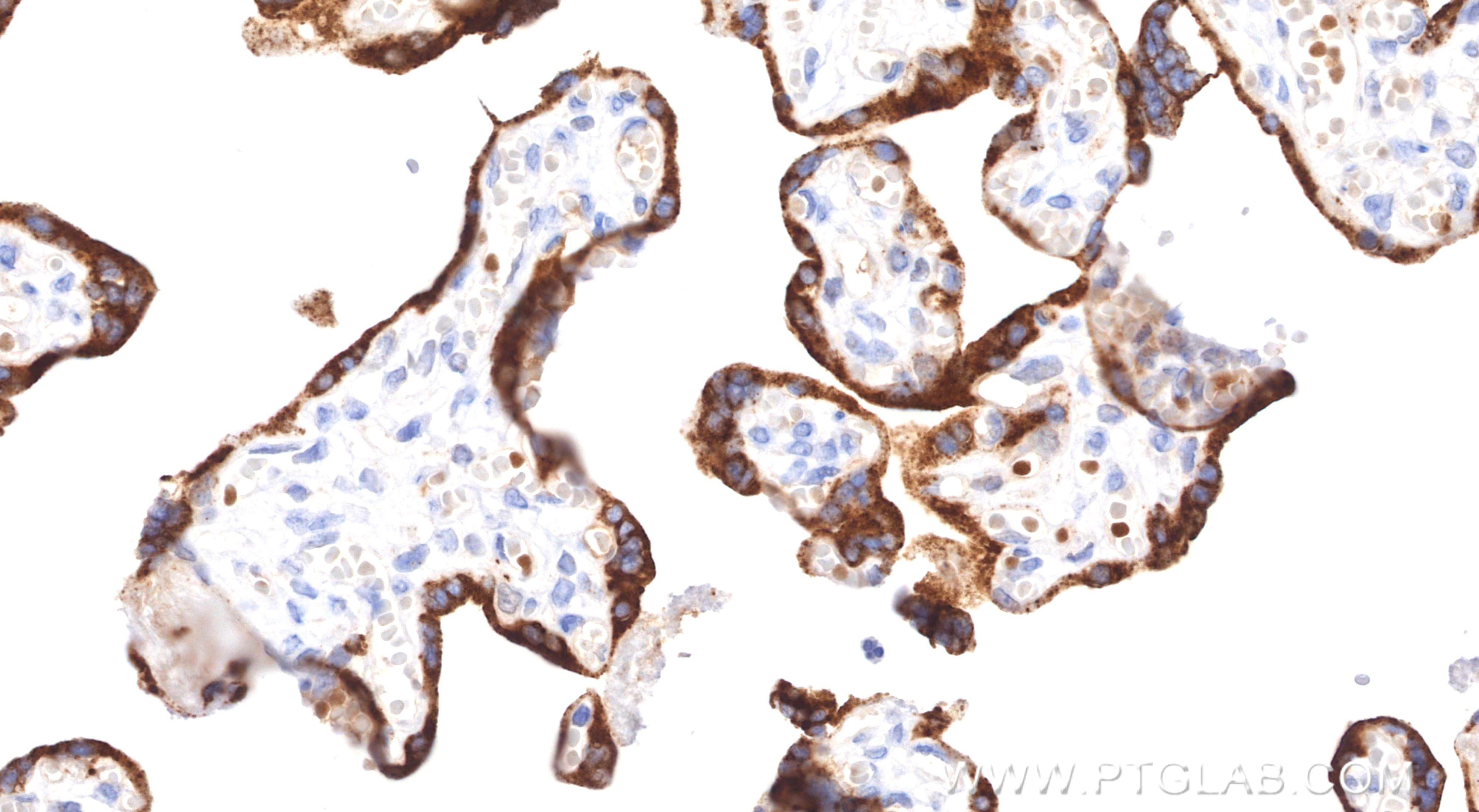 Immunohistochemical analysis of paraffin-embedded human placenta tissue slide using 83167-5-RR (TGFB2/TGF-beta 2 antibody) at dilution of 1:300 (under 40x lens). Heat mediated antigen retrieval with Tris-EDTA buffer (pH 9.0). Immunohistochemistry (IHC) staining of human placenta tissue using TGFB2/TGF-beta 2 Recombinant monoclonal antibody (83167-5-RR)