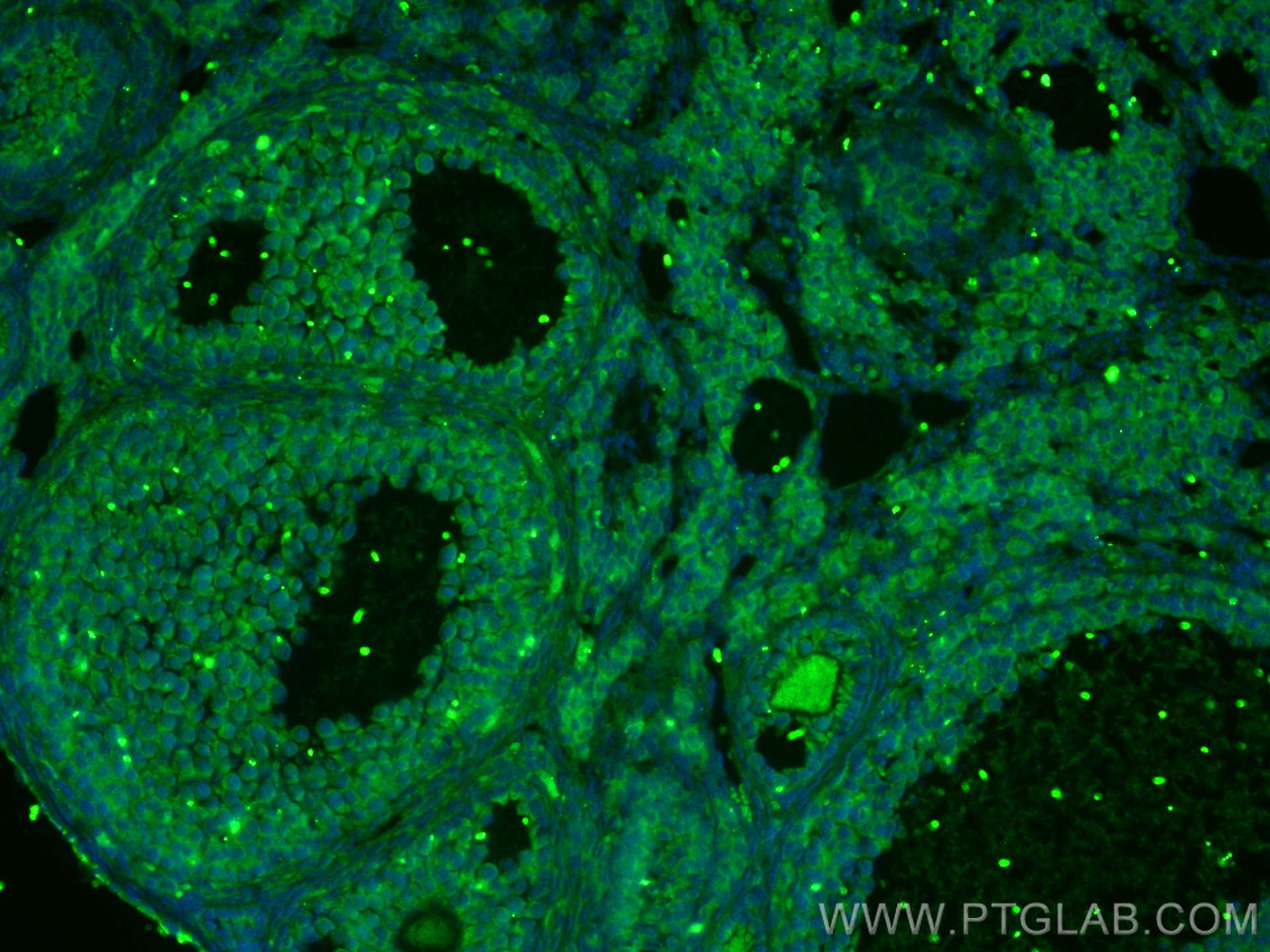 Immunofluorescence (IF) / fluorescent staining of mouse ovary tissue using TGF Beta 3 Polyclonal antibody (18942-1-AP)