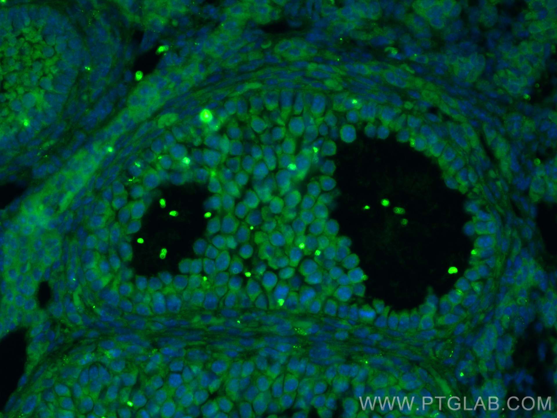 Immunofluorescence (IF) / fluorescent staining of mouse ovary tissue using TGF Beta 3 Polyclonal antibody (18942-1-AP)