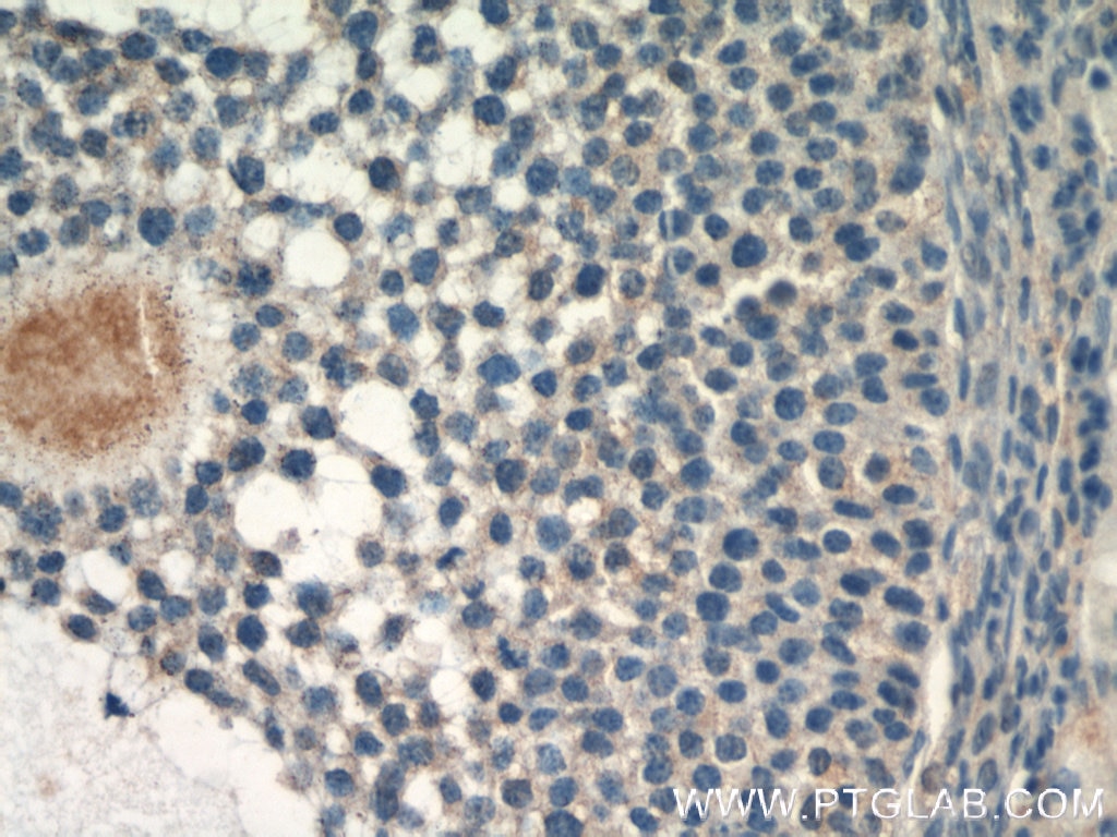 TGF Beta 3 Polyclonal antibody