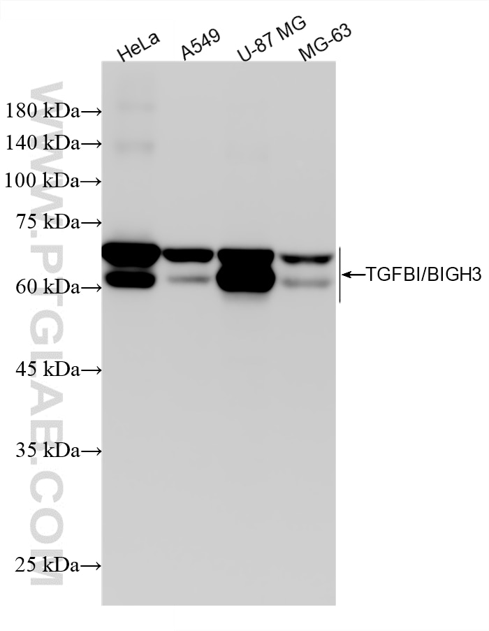 WB analysis using 80805-3-RR (same clone as 80805-3-PBS) Western Blot (WB) analysis of various lysates using TGFBI/BIGH3 Recombinant monoclonal antibody (80805-3-RR)