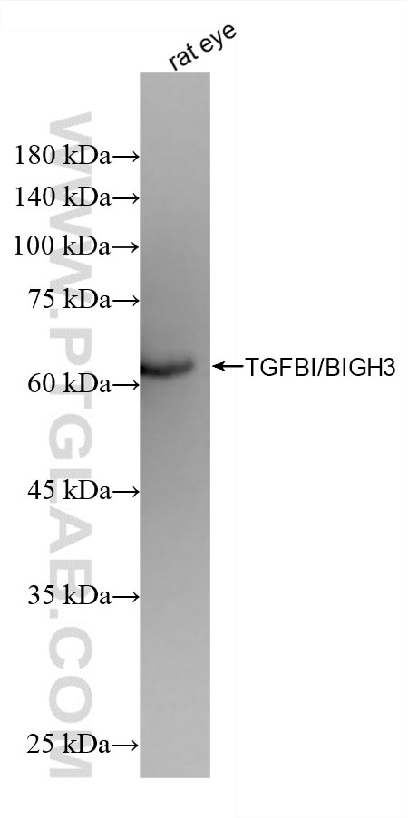 WB analysis of rat eye using 80805-3-RR (same clone as 80805-3-PBS) Western Blot (WB) analysis of rat eye tissue using TGFBI/BIGH3 Recombinant monoclonal antibody (80805-3-RR)