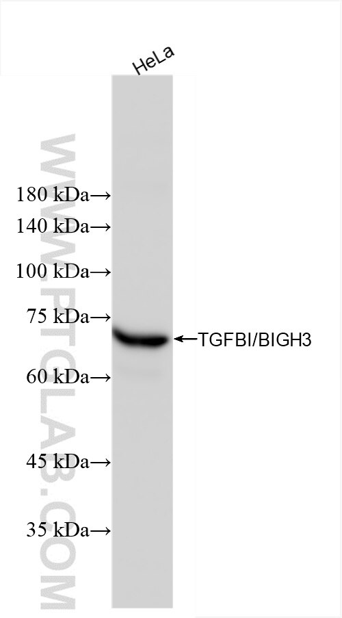 Western Blot (WB) analysis of HeLa cells using TGFBI/BIGH3 Recombinant antibody (80805-4-RR)