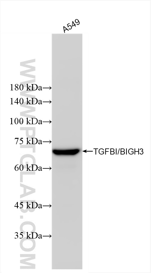 TGFBI/BIGH3