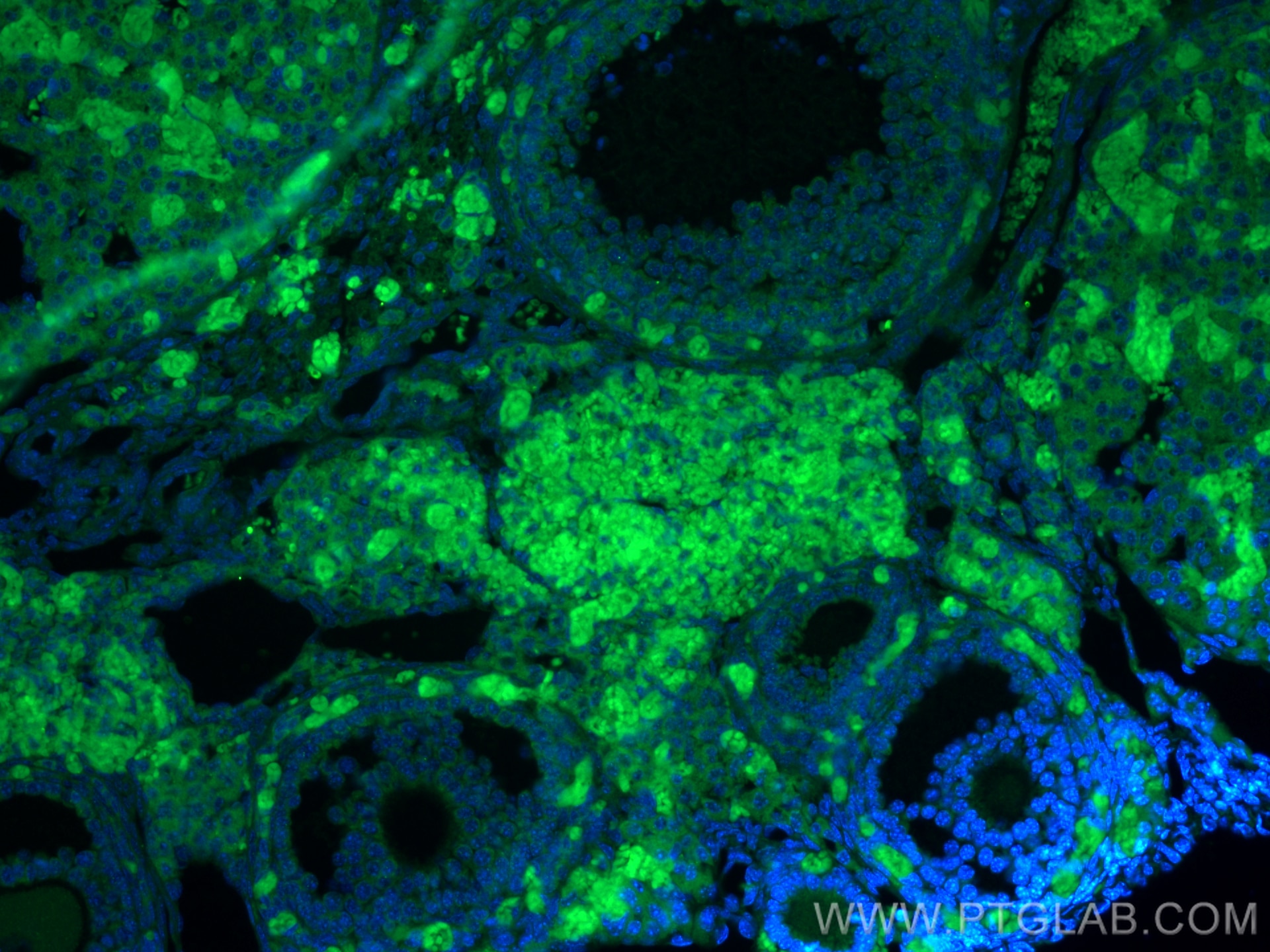Immunofluorescence (IF) / fluorescent staining of mouse ovary tissue using TGFBR1 Polyclonal antibody (30117-1-AP)