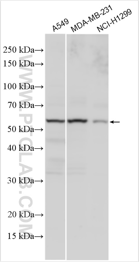 Western Blot (WB) analysis of various lysates using TGFBR1 Polyclonal antibody (30117-1-AP)