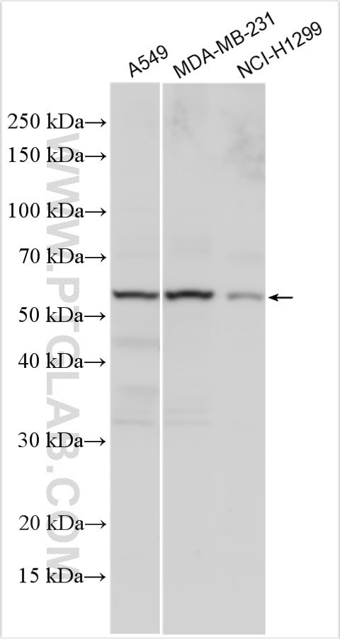 WB analysis using 30117-1-AP