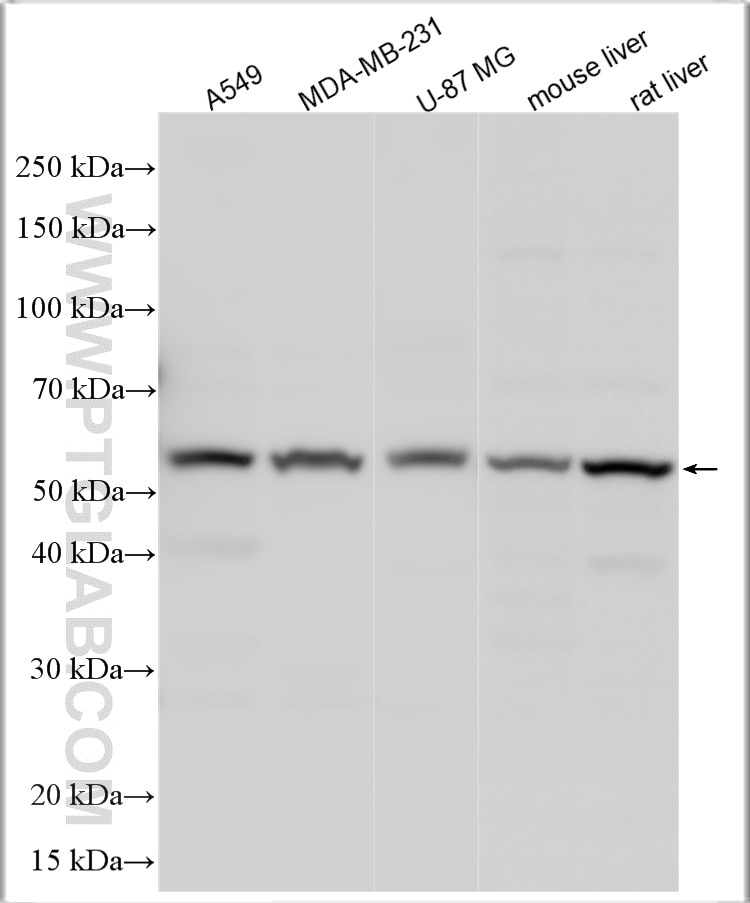 Western Blot (WB) analysis of various lysates using TGFBR1 Polyclonal antibody (30117-1-AP)