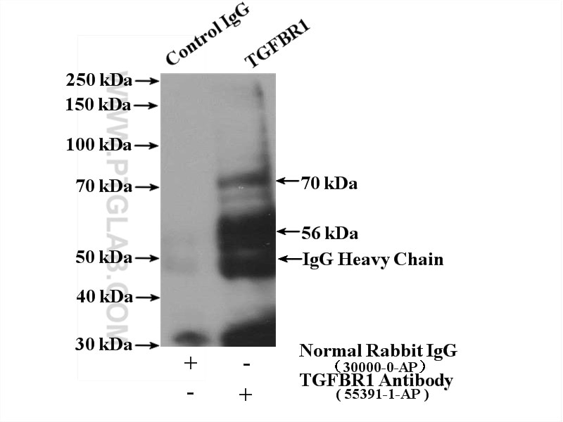 TGF Beta Receptor I Polyclonal antibody
