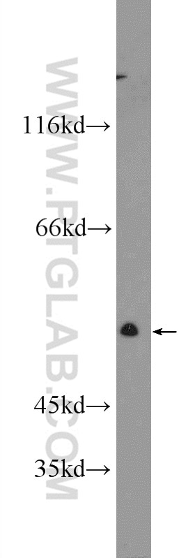 TGF Beta Receptor I Polyclonal antibody