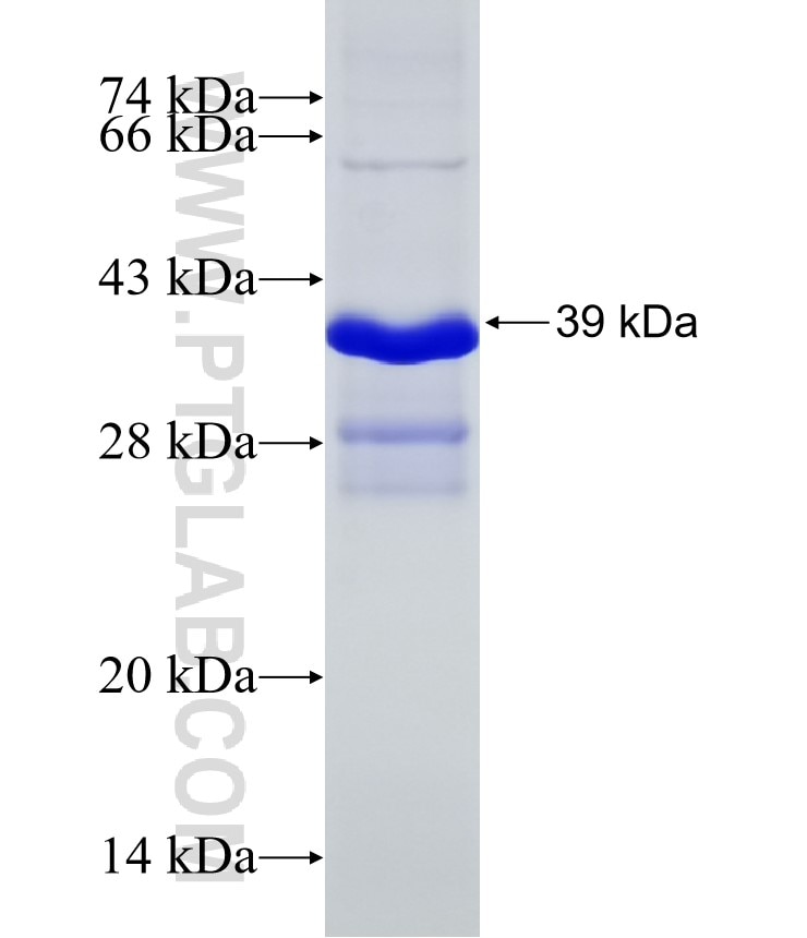 TGFBR1 fusion protein Ag31620 SDS-PAGE