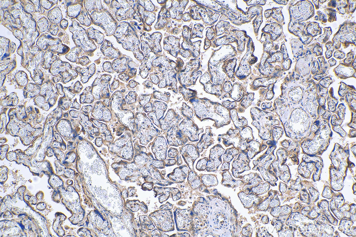 Immunohistochemistry (IHC) staining of human placenta tissue using TGFBR2 Polyclonal antibody (27212-1-AP)