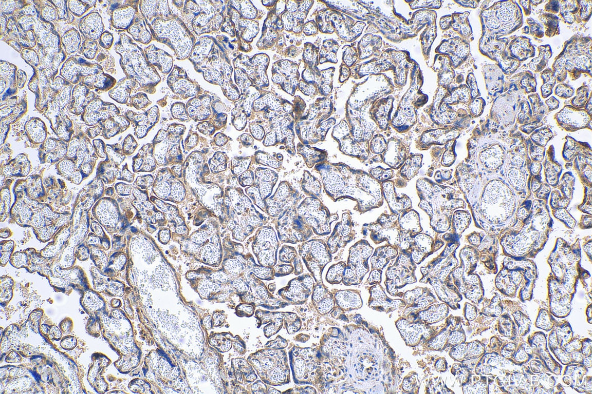 IHC staining of human placenta using 27212-1-AP