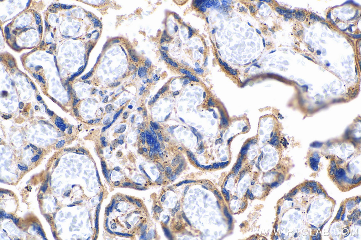 Immunohistochemistry (IHC) staining of human placenta tissue using TGFBR2 Polyclonal antibody (27212-1-AP)