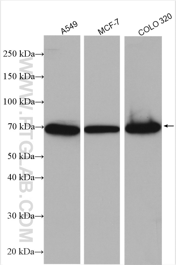 Western Blot (WB) analysis of various lysates using TGFBR2 Polyclonal antibody (27212-1-AP)
