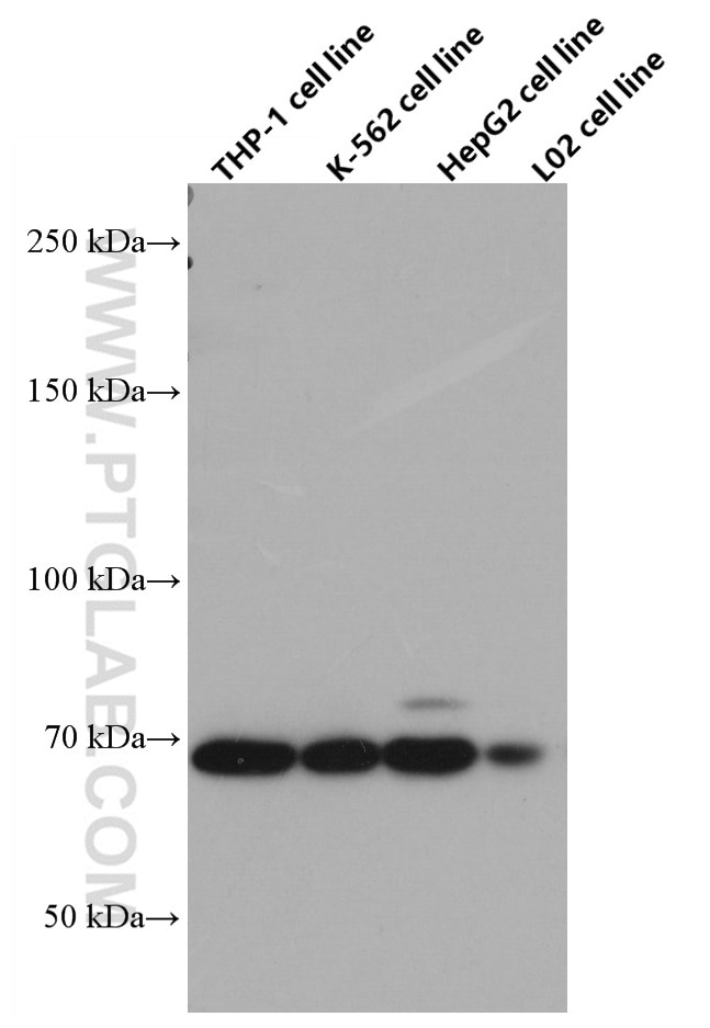 Western Blot (WB) analysis of various lysates using TGFBR2 Monoclonal antibody (66636-1-Ig)