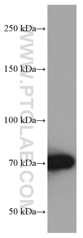 Western Blot (WB) analysis of A549 cells using TGFBR2 Monoclonal antibody (66636-1-Ig)