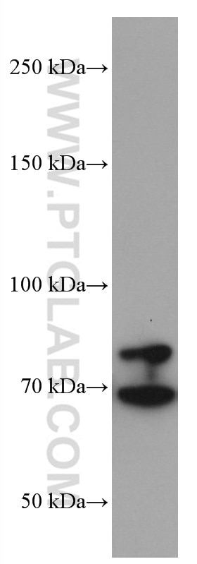 Western Blot (WB) analysis of HSC-T6 cells using TGFBR2 Monoclonal antibody (66636-1-Ig)