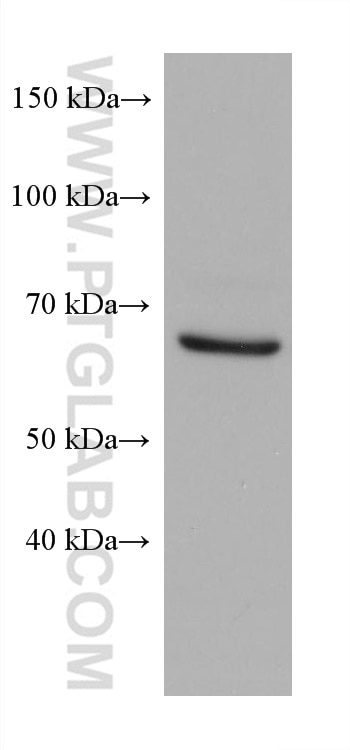 Western Blot (WB) analysis of U2OS cells using TGFBR2 Monoclonal antibody (66636-1-Ig)