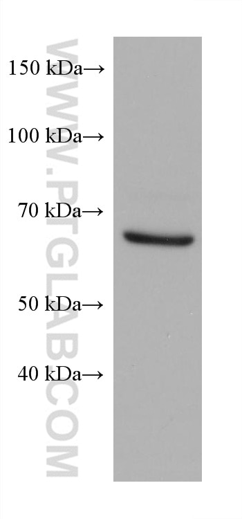 WB analysis of U2OS using 66636-1-Ig