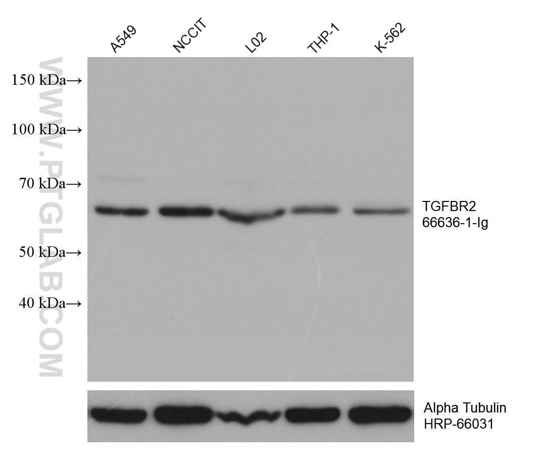 Western Blot (WB) analysis of various lysates using TGFBR2 Monoclonal antibody (66636-1-Ig)