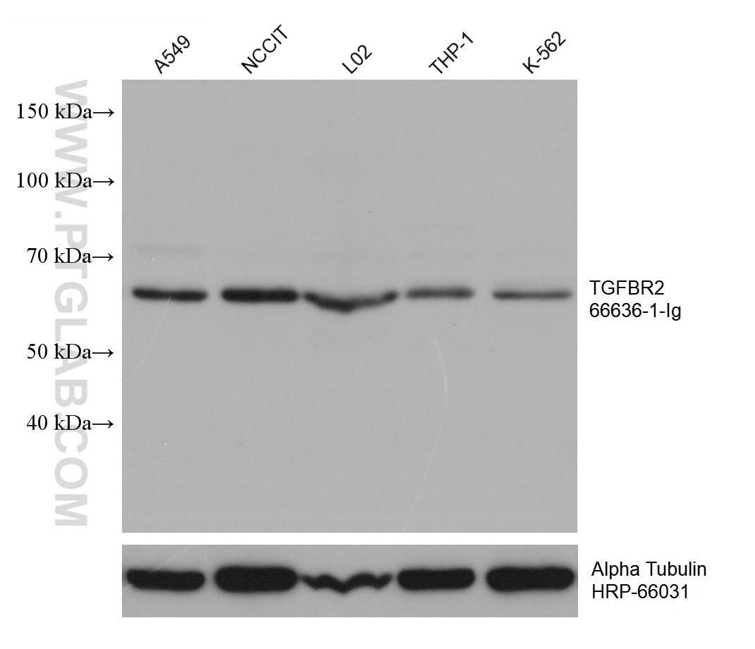 WB analysis using 66636-1-Ig